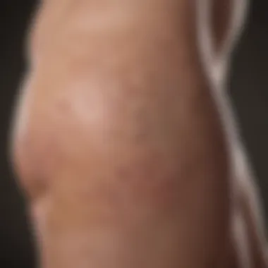Crafting a Skin Care Regimen to Combat Folliculitis on Legs Skin Care Routine for Folliculitis